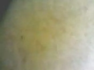 ڈاکٹر اس کا علاج جانتا ہے۔